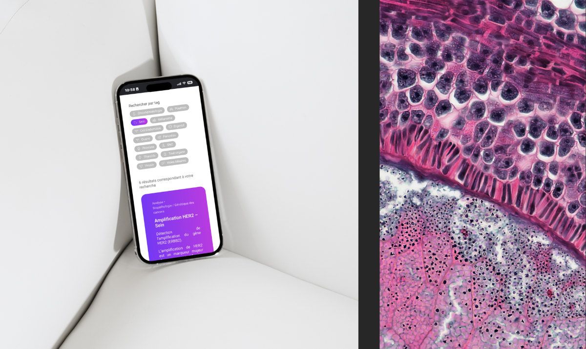 Montage de 2 photo avec un mockup de téléphone à gauche présentant le site Imagenome et un macro moléculaire à droite